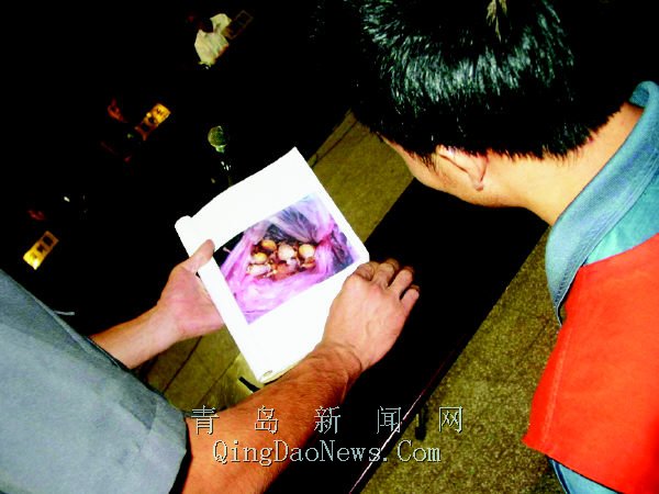 ��ڿ�������㡱��Ѽ�����ж��к�ʳƷ������������(ͼ)