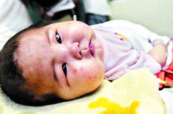 大头婴惊现羊城+广东查出大量问题奶粉