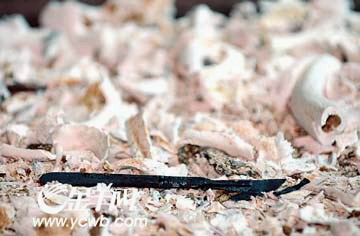 骨灰里惊现手术刀 杀人刀引出医患纠纷(图)