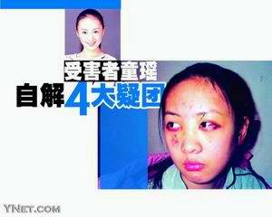 张默打人续:常大打出手 童瑶自解四大疑团(图)