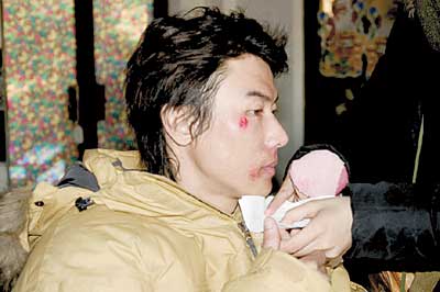 男一号金沛辰差点毁容